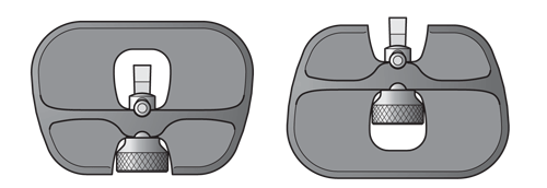 Iron alignment